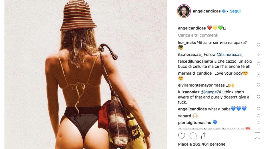 La curiosa cicatrice sul lato B di Candice Sweanepoel: "Vaccino in Africa"