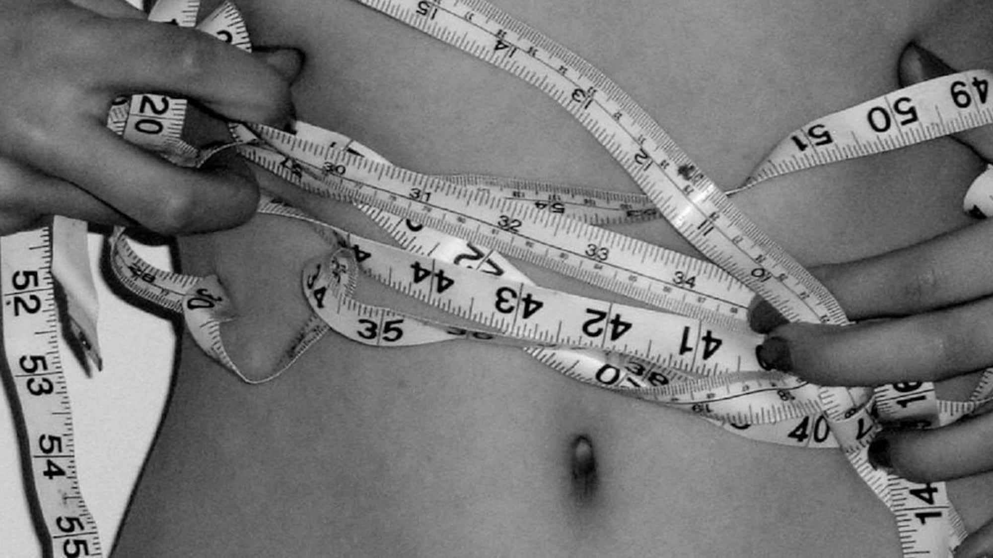 Anoressica, muore abbandonata: il compagno finisce a processo