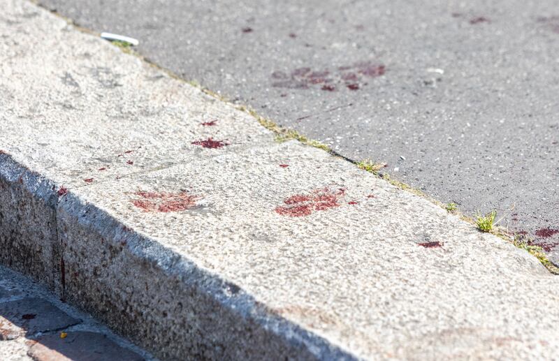 ragazzo accoltellato con il cane e soccorso da un passante. Gravissimo 5