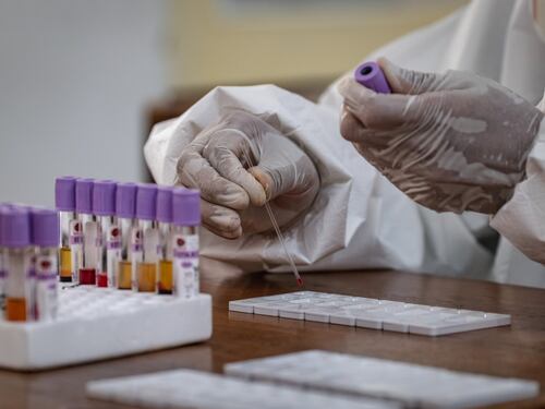 "Non segnaliamo alle Asl i positivi". È bufera sui test sierologici