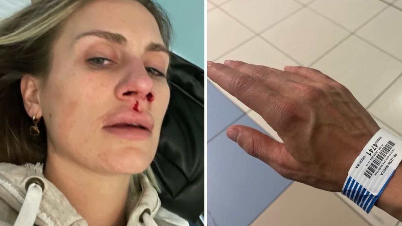 Lo svenimento, il sangue, la corsa in ospedale: cosa è successo a Nikita Pelizon del Grande Fratello 2023