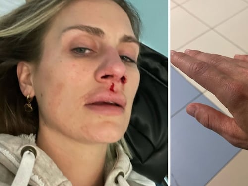 Lo svenimento, il sangue, la corsa in ospedale: cosa è successo a Nikita Pelizon del Grande Fratello 2023