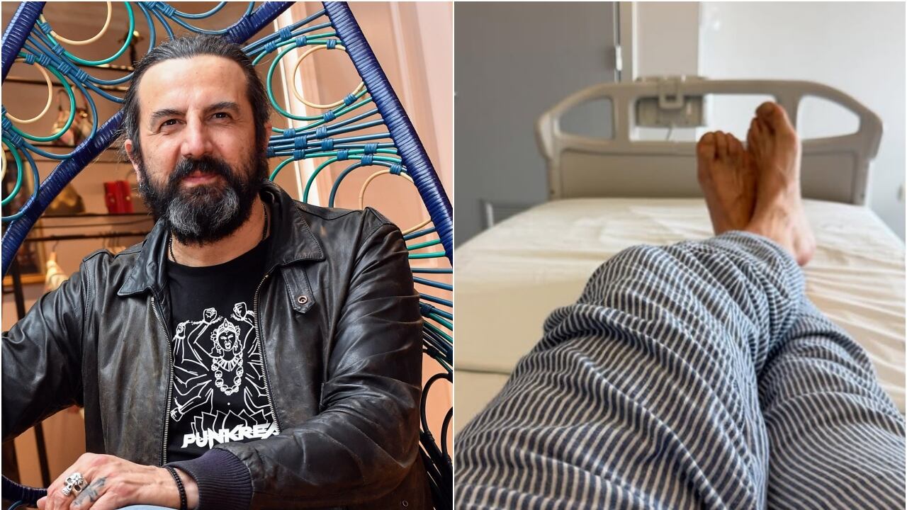 "In coma per quattro giorni". Complicazioni per Omar Pedrini dopo l'operazione al cuore