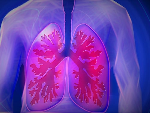 Tumore al polmone, una nuova cura mirata: cos'è la terapia a target molecolare