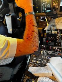 Il vetro in frantumi, il pilota ferito: le immagini del Boeing 737 colpito a 11mila metri 3