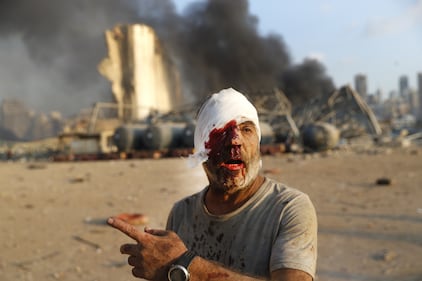Beirut, due esplosioni devastano il porto 3