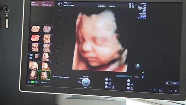 Treviso si scopre precoce con due mamme bambine