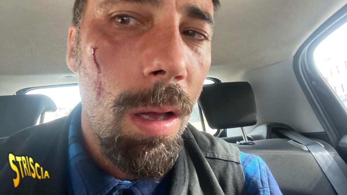 "Ha mostrato i genitali alla telecamera": arrestati gli aggressori di Brumotti