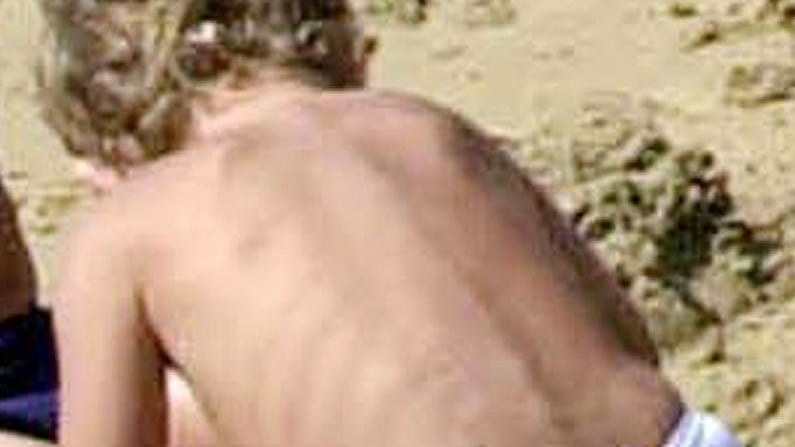 Bimbo muore colpito in spiaggia da un fulmine
