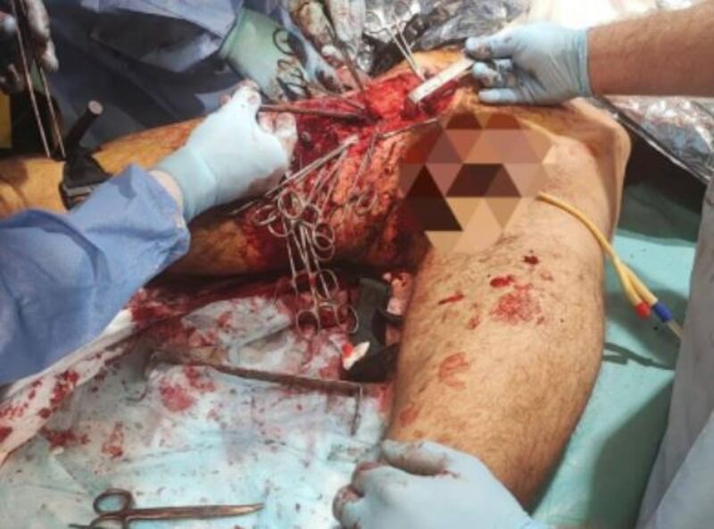 Le foto choc dall'ospedale dell'acciaieria Azovstal 5