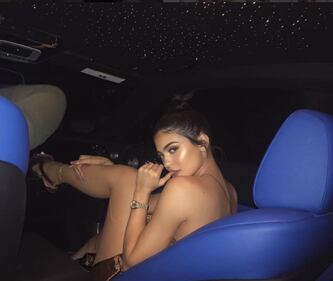 Kylie Jenner e la sexy cicatrice 2