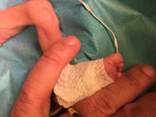 Belgio, nutrono il figlio con latte di quinoa e avena: Lucas muore a 7 mesi