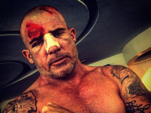 Brutto incidente per Dominic Purcell, attore di Prison Break
