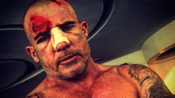 Brutto incidente per Dominic Purcell, attore di Prison Break