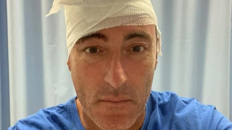 Brutta ferita alla testa per l'assessore Giulio Gallera