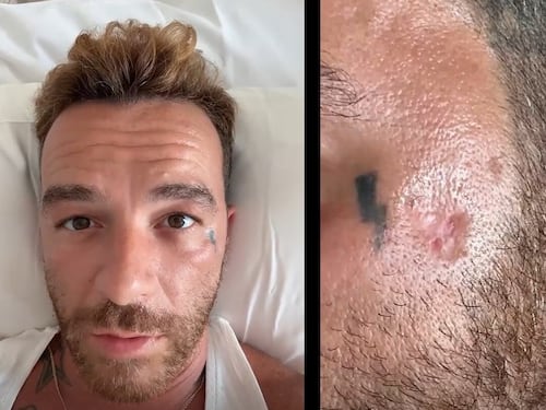 Salmo choc sui social: “Ho il cancro alla pelle per colpa delle creme solari”. È bufera sui social