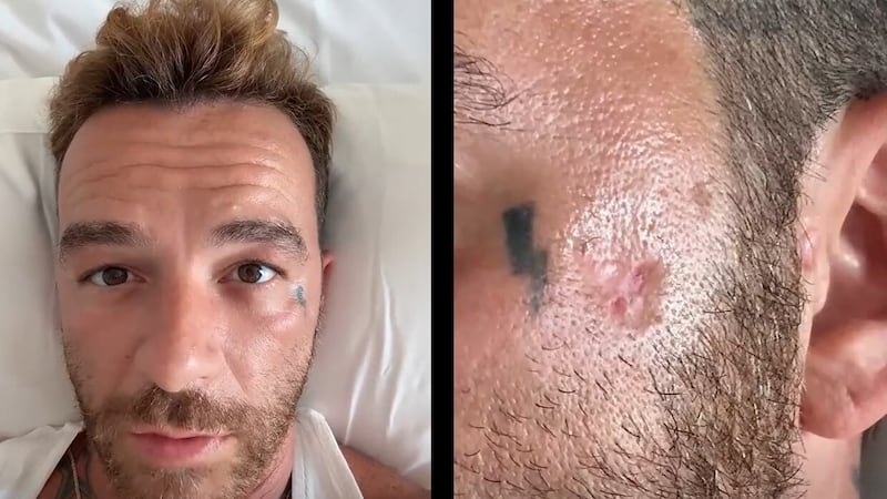 Salmo choc sui social: “Ho il cancro alla pelle per colpa delle creme solari”. È bufera sui social