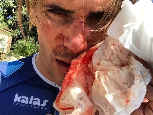 Picchiato e minacciato Offredo: "Aggredito con mazza e coltello"