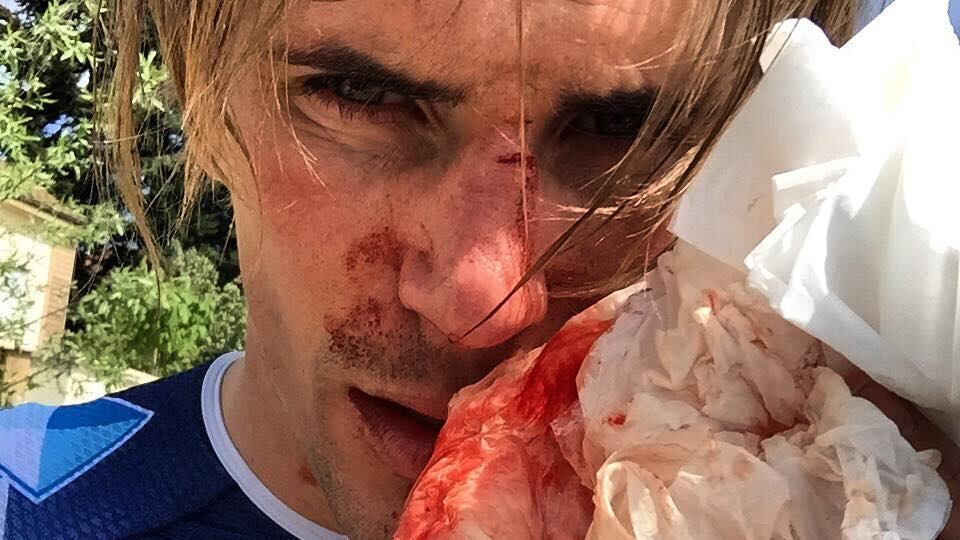 Picchiato e minacciato Offredo: "Aggredito con mazza e coltello"