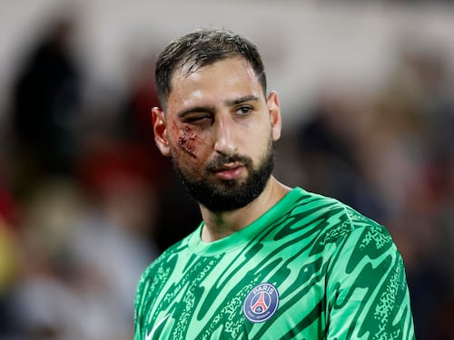 Quella cicatrice sul volto di Gigio che il PSG ha dimenticato troppo in fretta.