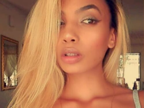 Modella picchiata dalla first lady dello Zimbabwue