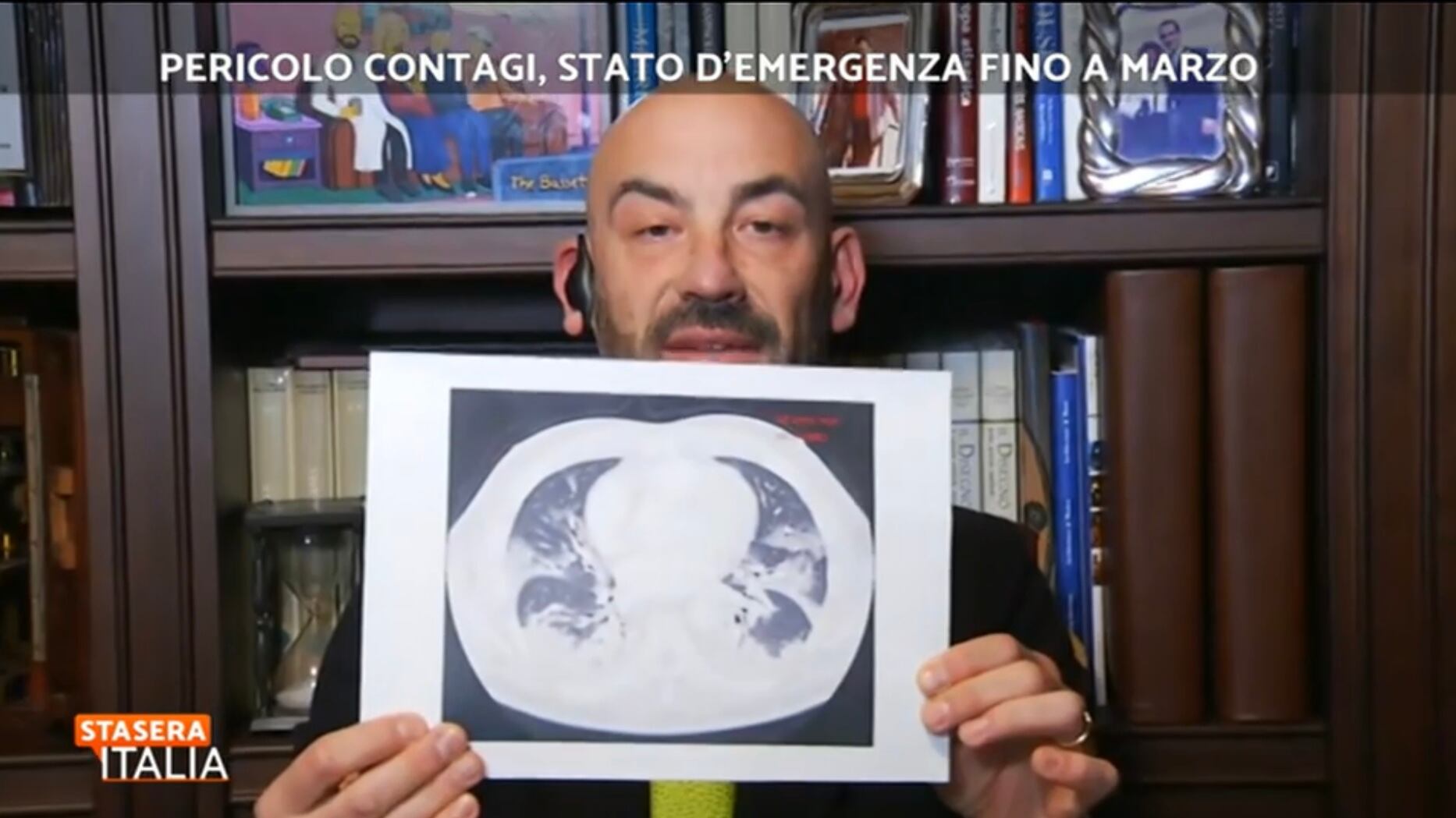 "Guardate le TAC dei no vax, sono devastanti": l'allarme di Bassetti in tv