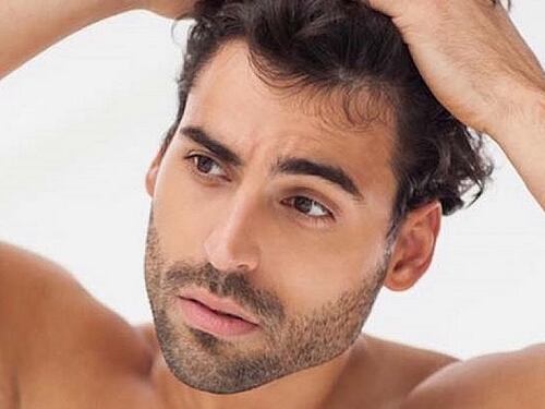 Cura Calvizie, dal PRP Capelli ad hCRP Sonicato: è l’evoluzione