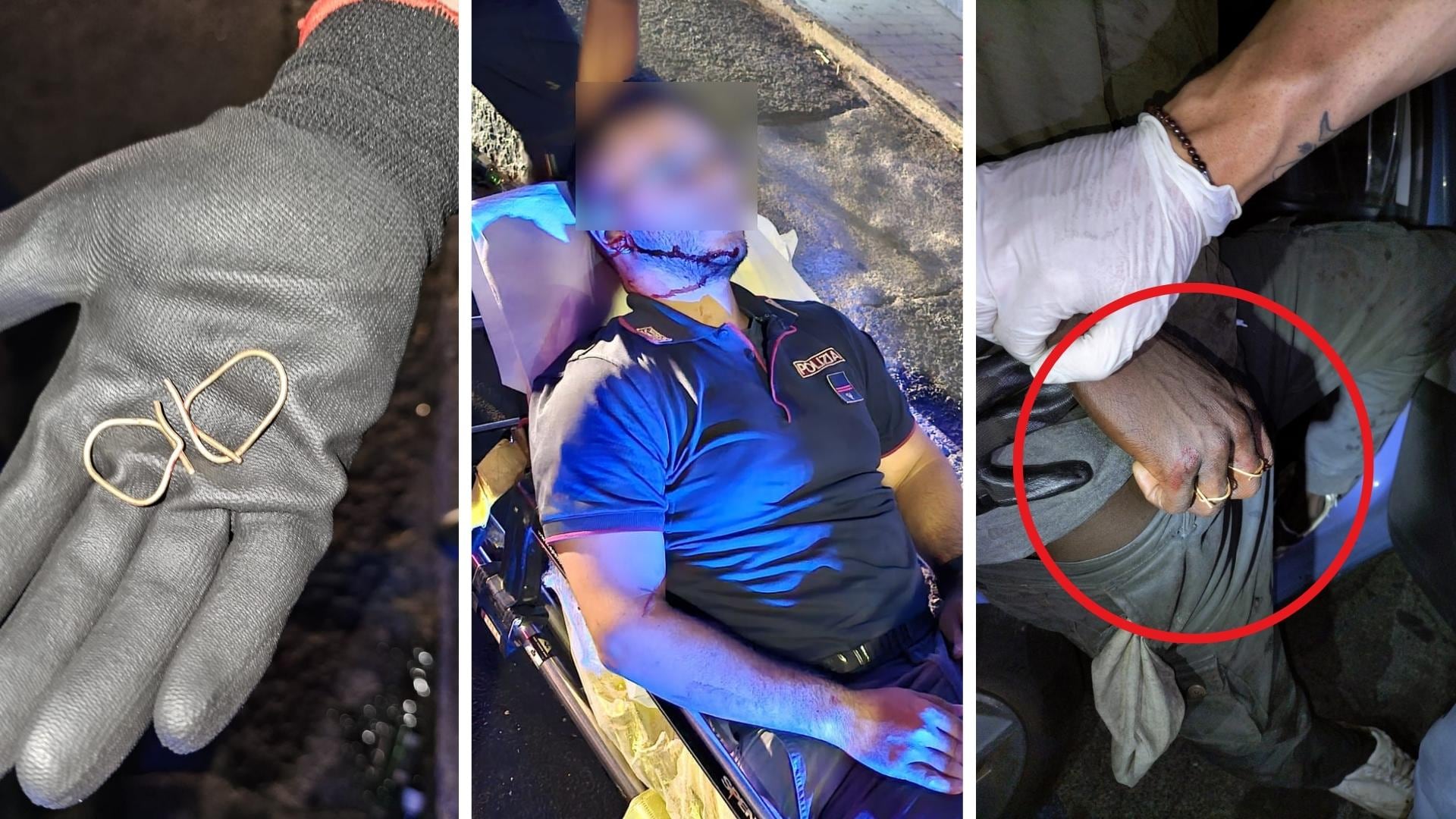 L'anello a forma di uncino: l'arma choc contro i poliziotti