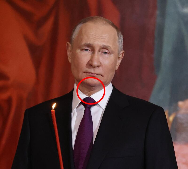 Il presidente russo durante la messa per la Pasqua ortodossa e la cicatrice alla gola che secondo alcuni avvalorerebbe le teorie secondo cui Putin è malato di cancro e usa i sosia.