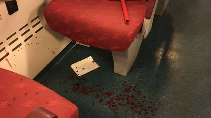 Spacca la testa a una donna per pochi euro. Ma il giudice "grazia" il romeno