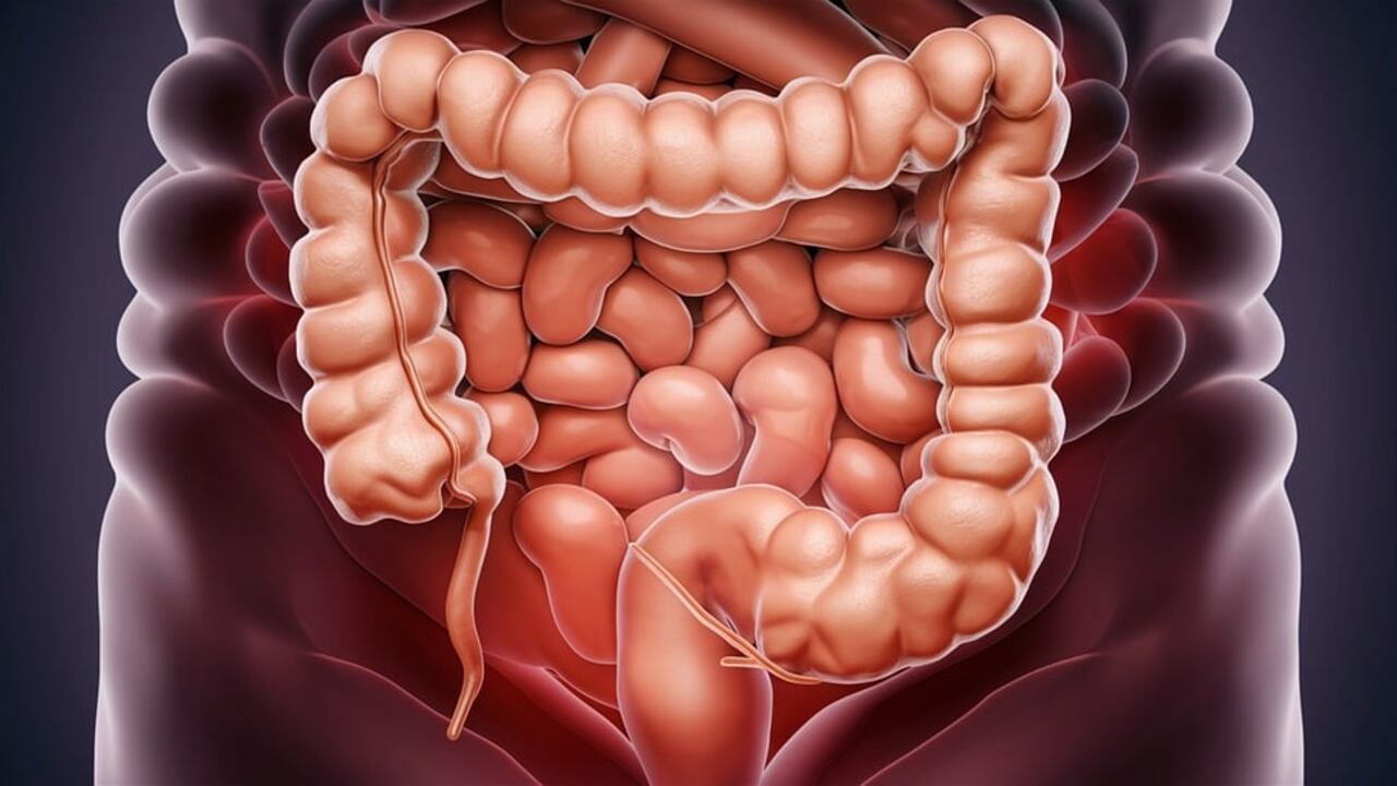 Tumore al colon-retto, quali sono i sintomi iniziali: ecco come avviene la diagnosi