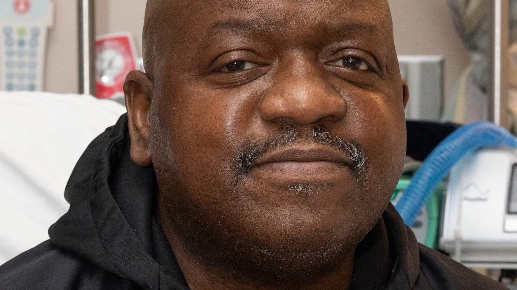 Ebbe un rene di maiale: morto dopo 2 mesi