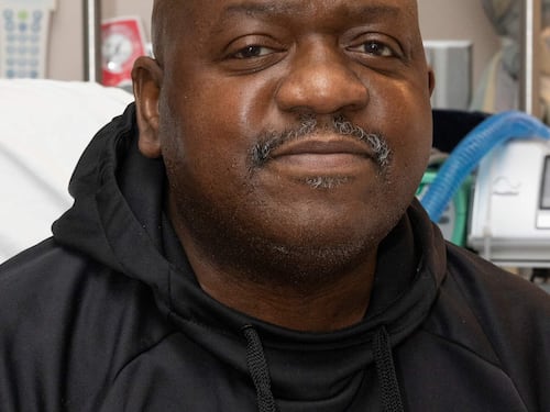 Ebbe un rene di maiale: morto dopo 2 mesi