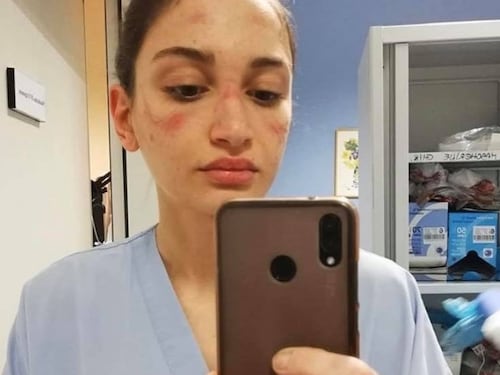 L'infermiera con il volto segnato dalla mascherina: "State in casa"