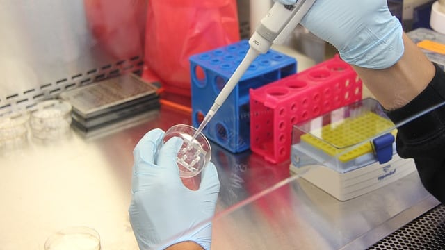 Malattie autoimmuni, un'impronta digitale rivela qual è il trattamento migliore
