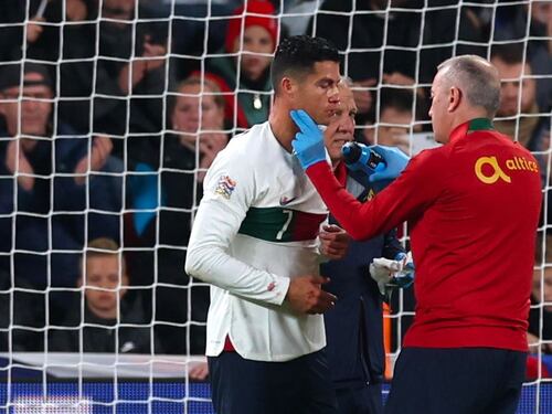 CR7 va ko dopo lo scontro con il portiere: sangue dal naso e spavento per l'ex Juve