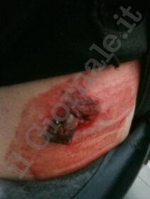 Le foto choc del poliziotto ferito da un bullone 2