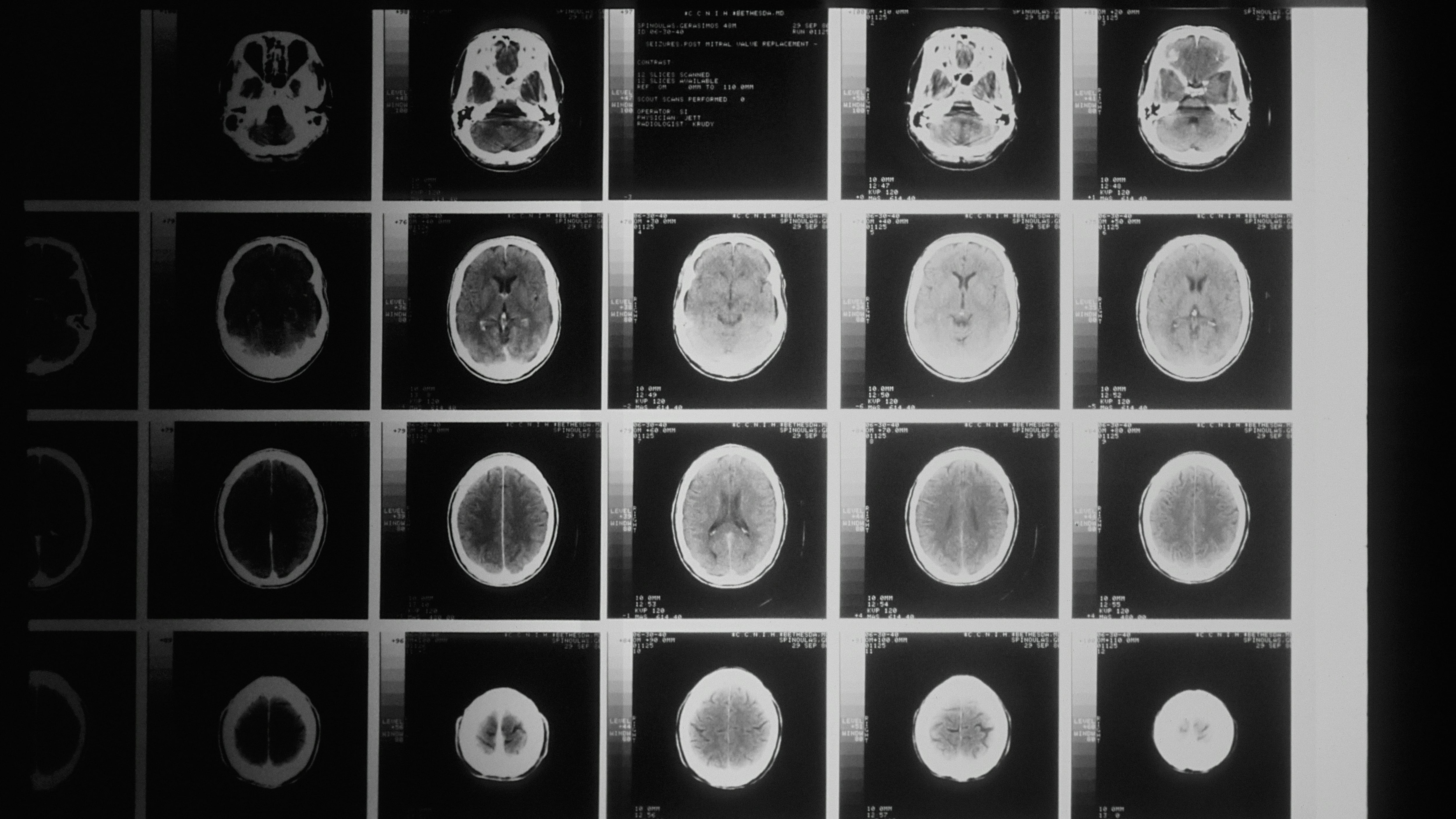 Cancro, quali sono i 4 sintomi "insoliti" da non sottovalutare