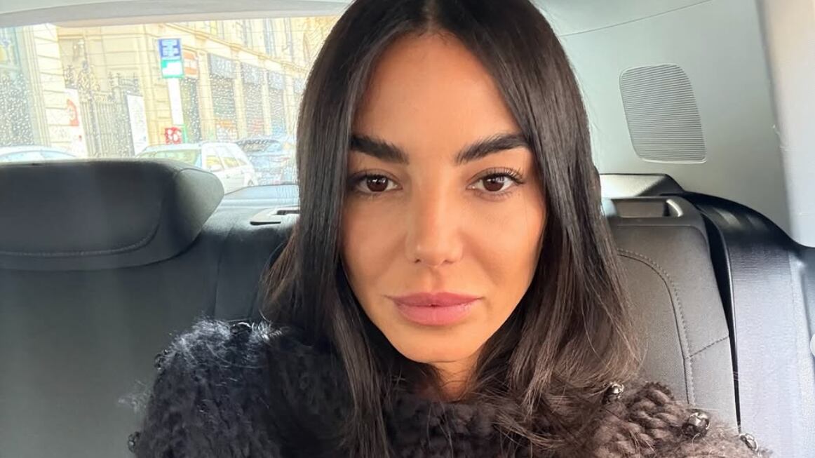Chiara Biasi e il danno dei filler volumizzanti: "Non fateli, io provo a rimuoverli da 6 anni"