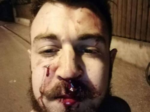 Bolzano, canta "Bella ciao" e viene aggredito