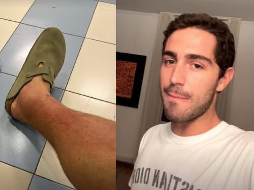 "Sospetta trombosi". Tommaso Zorzi finisce in ospedale, ma la diagnosi è un'altra