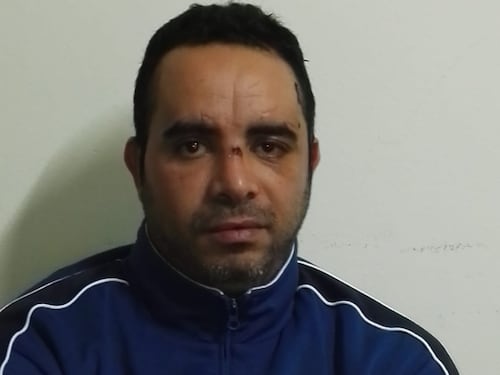 Litiga con un connazionale e lo accoltella: agli arresti un marocchino