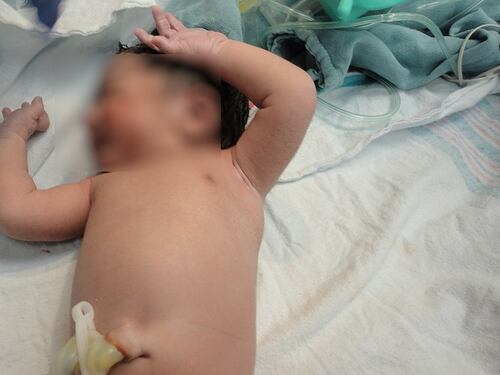 Caserta, partorisce in auto davanti al marito e ai tre figli