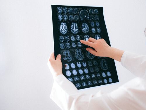Ictus, le nuove linee guida del Ministero della Salute