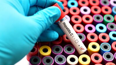 Un gene può bloccare le epatiti B, C e D. La scoperta che cambia tutto