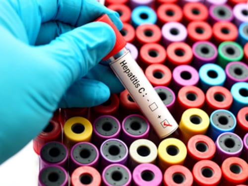 Un gene può bloccare le epatiti B, C e D. La scoperta che cambia tutto