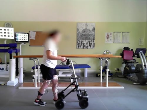 Paralizzata torna a camminare dopo 5 anni: straordinario intervento al San Raffaele