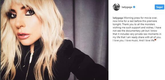 Lady Gaga, le immagini più famose 14