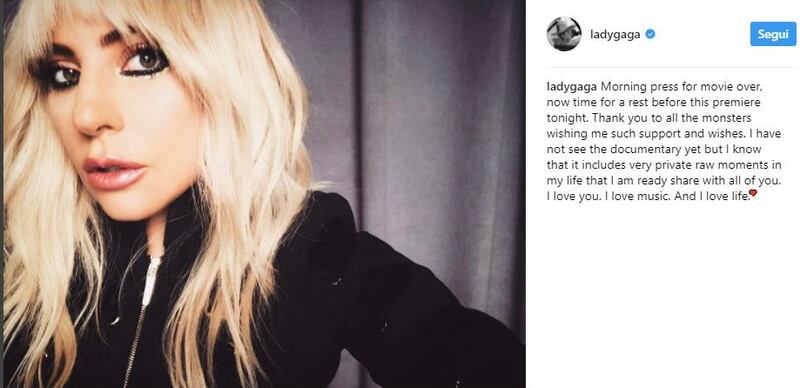 Lady Gaga, le immagini più famose 14