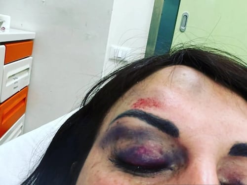 Divieto di avvicinamento per l'ex di Francesca De André dopo le aggressioni